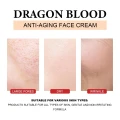 Eelhoe Dragon-s-Blood-Facial-Anti-Wrinkle-Serum-Dragon-Blood-Anti-Ageing-Serum4.jpg